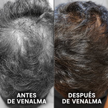Barra Revitalizante Coreana